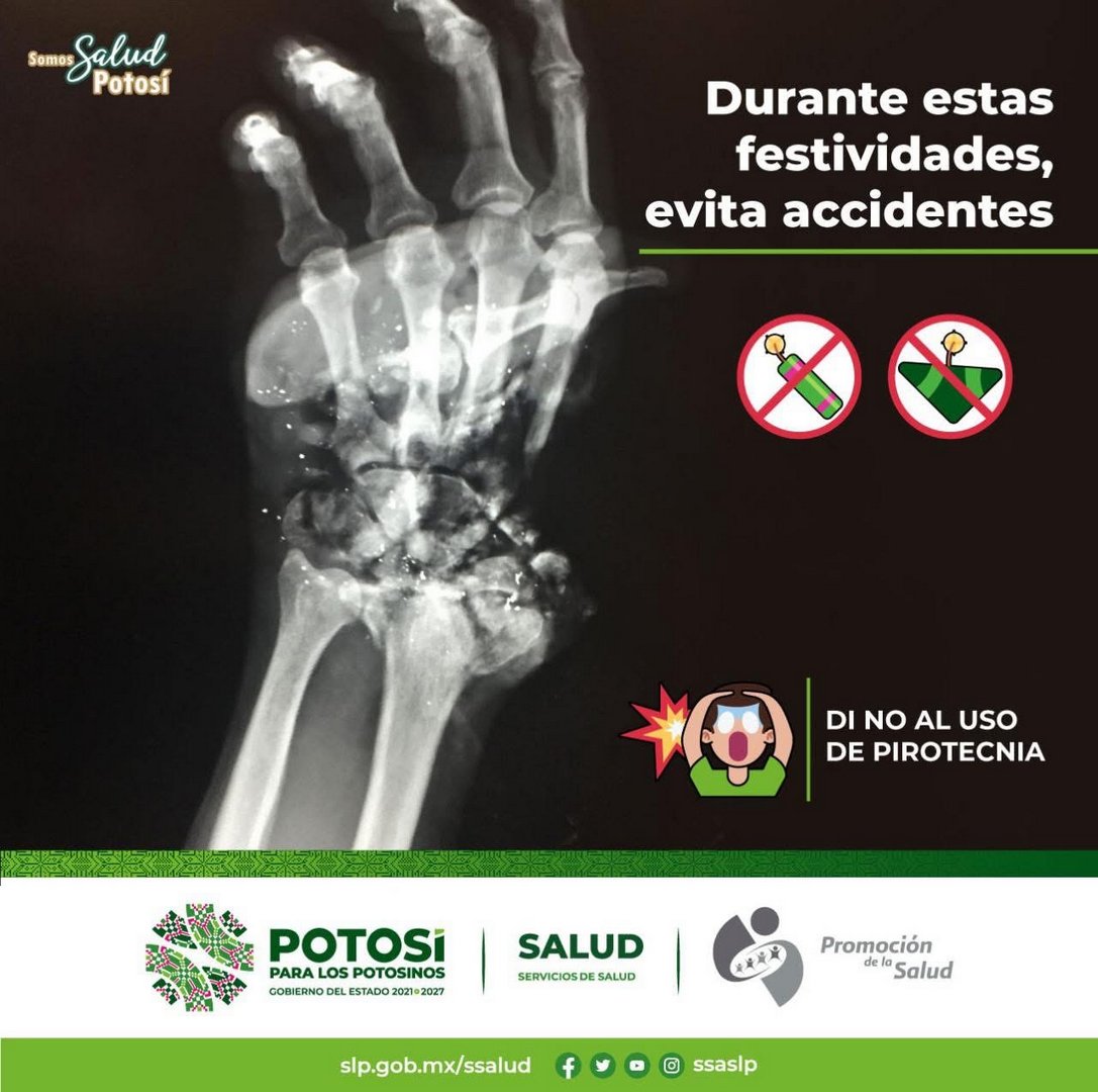 El estado fortalece prevención de accidentes por uso de pirotecnia